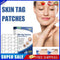 #A 144pcs Skin Tag Remover Patches Breathable Wart Treatment Stickers Cleaning