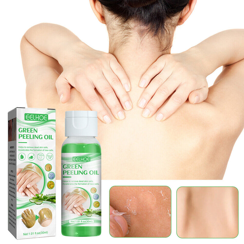 30ml Exfoliating Essence Oil Remove Blackheads Whitening Care Skin Oil for