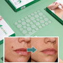 Invisible Wart Treatment Skin Tag Pimple Remover Acne Wart Remove Acne Patch