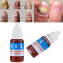 Anti Fungal Treatment Fungus Effective Finger Toe Nail Repair Liquid Solu F7X0