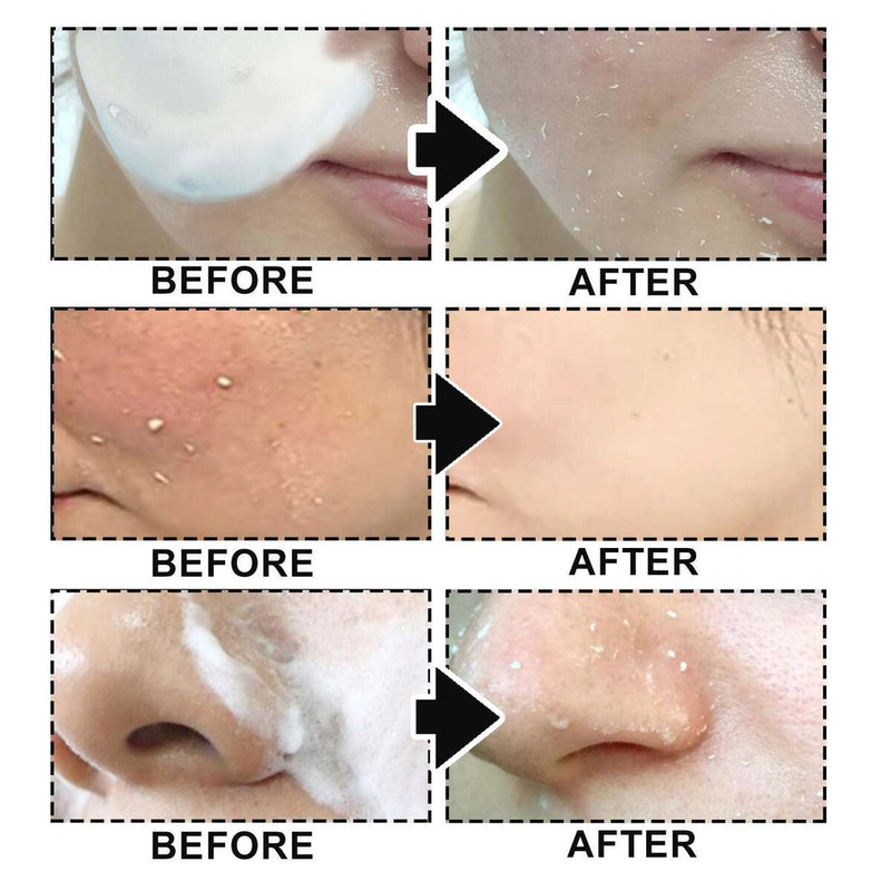 60ml Facial Exfoliating Mousse Deep Remove Cleaning Peeling Gel Skin Care Smoot&