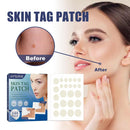 Skin Tag Remover Patches Acne Pimple Moles Wart Remover 144 Pcs`