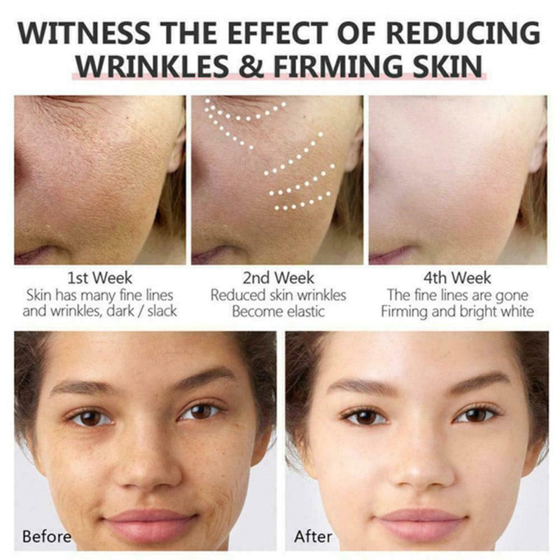 Turmeric Oil Skin Acne Clear Skin Dark Spot Corrector Whitening Serum Faces care