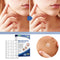 #A 144pcs Skin Tag Remover Patches Breathable Wart Treatment Stickers Cleaning