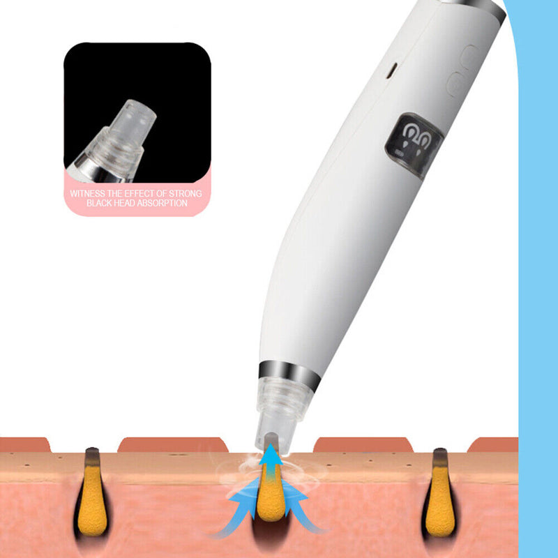 Blackhead Vacuum Pore Machine Deep Face Nose Cleaner Portable Beauty Care Tool