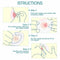Grade Silicone Frosted Nipple Everters with Storage Case Nipple Protector Clear