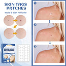 144pcs Skin Tag Remover Patches Wart Treatment Herbal Stickers Plasters Newly