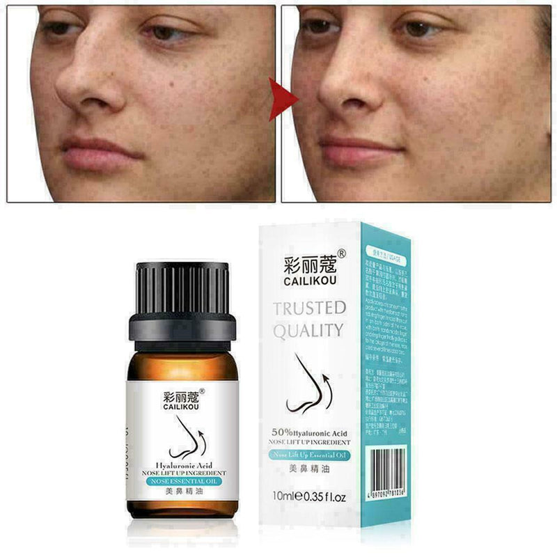 Nose Up Heighten Rhinoplasty Essential Oil 10ml Nasal Bone Rmodeling R6J3 Q6Q0