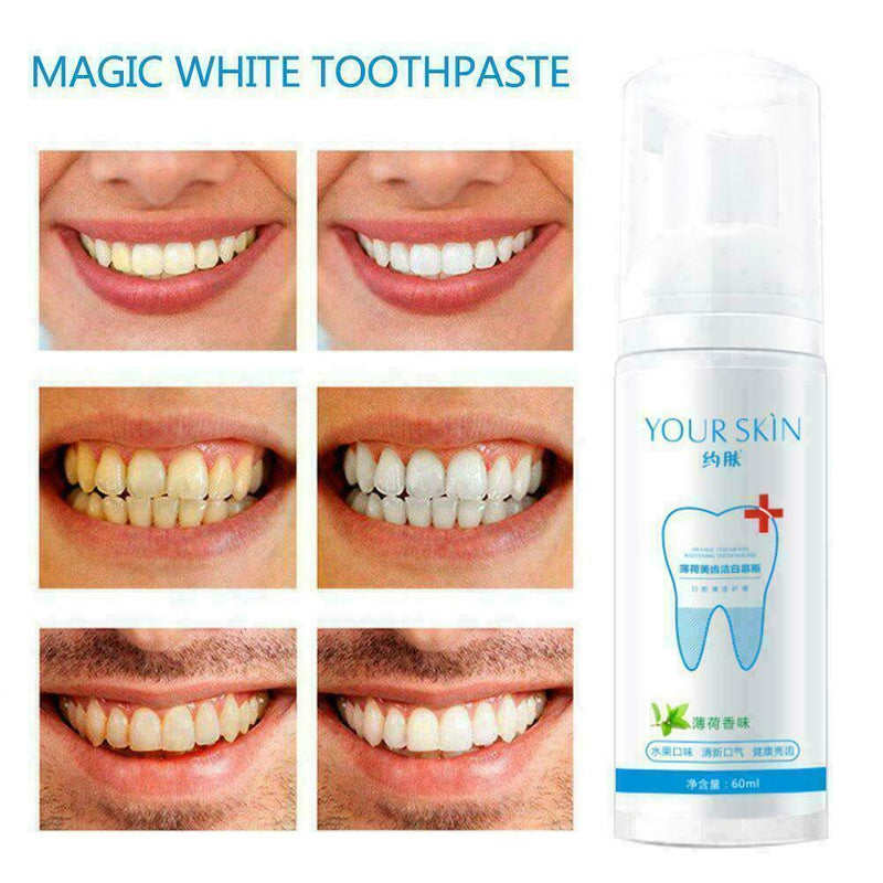 Teeth-Cleaning Whitening Mousse Toothpaste Removes Plaque W4R7 Stains O5D9