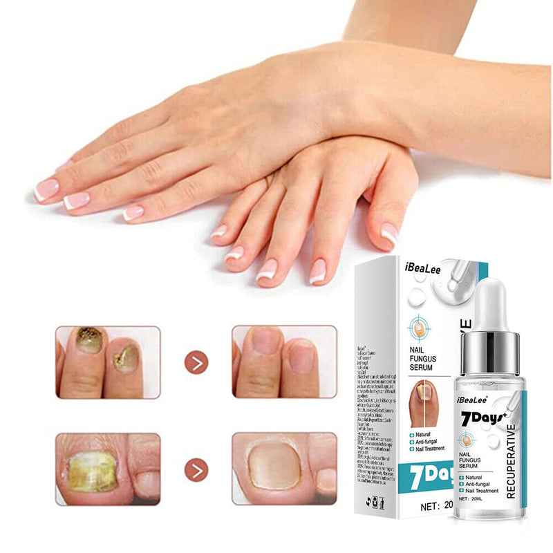 20ml Nail Repair Fluid Anti Infection Paronychia Essence Effective for Foot Care