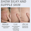 Acid Flowers Essential Oil Cleansing Bath Soap Moisturizing UK: