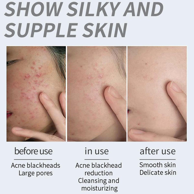 Acid Flowers Essential Oil Cleansing Bath Soap Moisturizing UK: