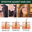 Ginger Hair Shampoo Anti Dandruff Anti-Itching Cleansing Control Nourishing X4W3