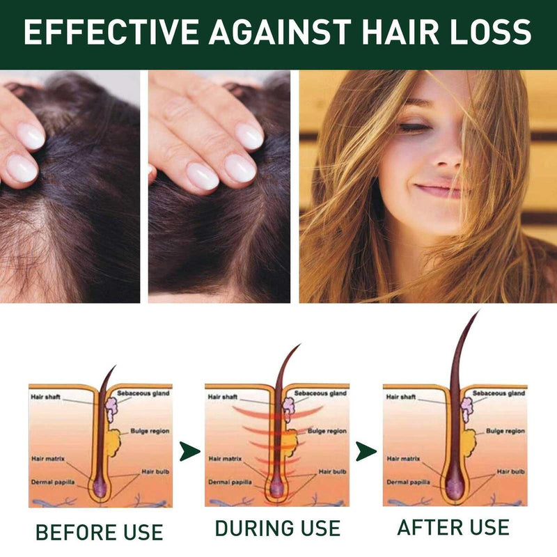 Ginger Hair Shampoo Anti Dandruff Anti-Itching Cleansing Control Nourishing X4W3