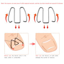 Ingrown Toe Nail Correction Hook/Rubber Band Paronychia Orthosis Corrector Clips