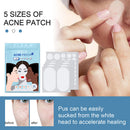 80pcs Acne Patches Pimple Remover Invisible Spot Stickers Facial Care Beauty