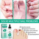 30ml Toenail Fungus Oil Nail Repair Liquid for Fingernails Anti Fungal Whitening