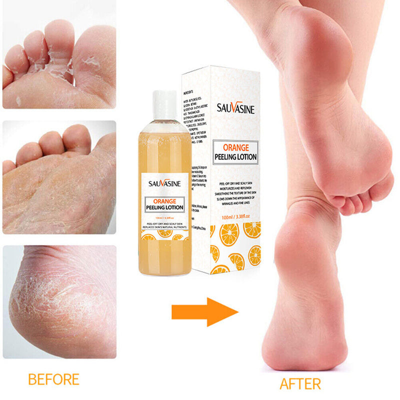 100ml Orange Peeling Lotion Remove Armpit Dark Skin Exfoliating Whitening