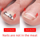 1 Pair Stainless Steel Ingrown Toe Nail Fixer Embed Toenail Correction Lifter