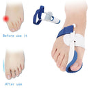 Supplies Toe Valgus Foot Corrector Toe Separator Thumb Valgus Orthotics