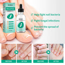 30ml Toenail Fungus Oil Nail Repair Liquid for Fingernails Anti Fungal Whitening
