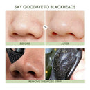 1x Blackhead Remover Nose Strips Deep Cleaning Treatment Black W3H6 C6D6 Q5C5