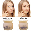 Aufhellende Anti-Freckle-Gesichtscreme Dark Spot Corrector Woman Face Care.