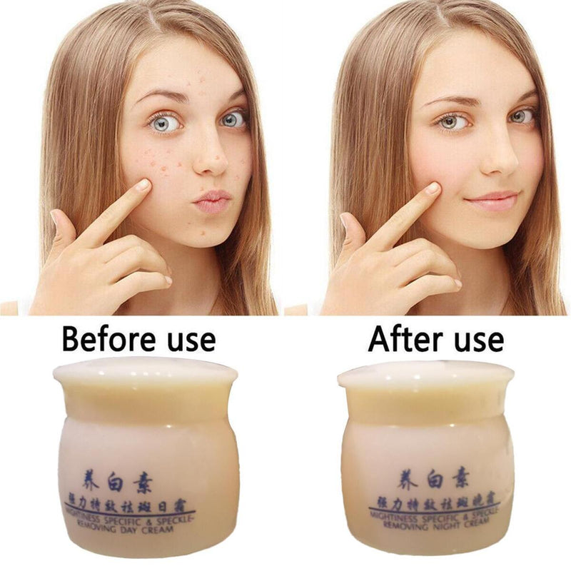 Aufhellende Anti-Freckle-Gesichtscreme Dark Spot Corrector Woman Face Care.