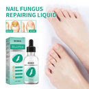 30ml Toenail Fungus Oil Nail Repair Liquid for Fingernails Anti Fungal Whitening