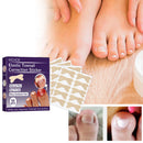 50pcs Stickers Ingrown Toenail Correction Paronychia Treatment Recover Stickers