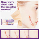 4pcs Silicone Scar Sheets Gel Strips Patch Reusable Scar Removes Remove Tra