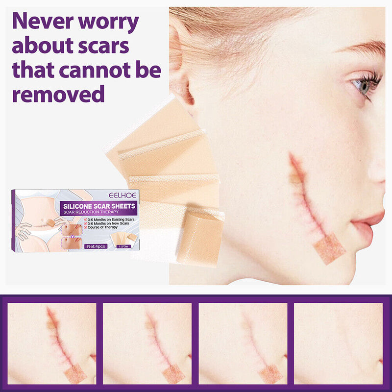 4pcs Silicone Scar Sheets Gel Strips Patch Reusable Scar Removes Remove Tra