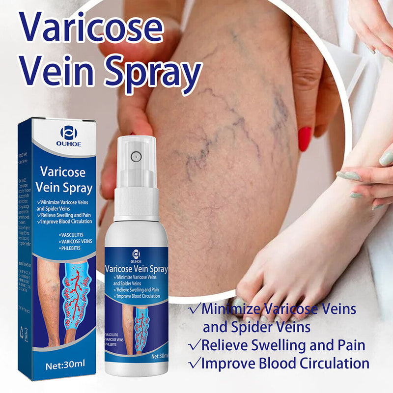 Varicose Vein Spray Sooting Leg Acid Bilges Itching Solution Body Care 30ml