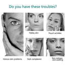 #A Safety Silicone Ice Tray Remove Fine Lines Health Face Roller Shrink Pores