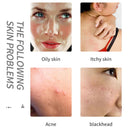 Acid Flowers Essential Oil Cleansing Bath Soap Moisturizing UK: