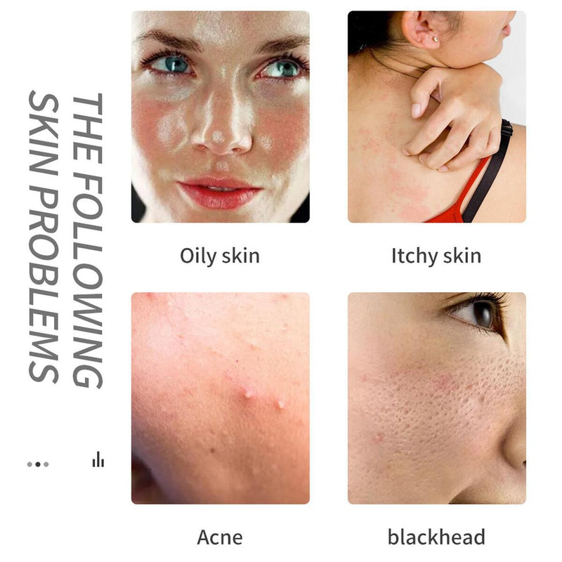 Acid Flowers Essential Oil Cleansing Bath Soap Moisturizing UK: