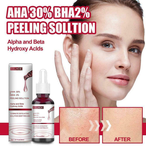 Fruit Salicylic Acid Essence, Anti-Acne Exfoliating Serum, Shrink Pores K8R7