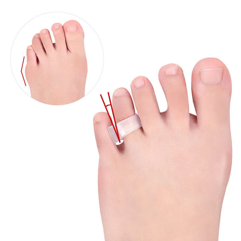 Silicone Feet Protector Bunion Corrector Hallux Valgus for Feet Care Pedicure
