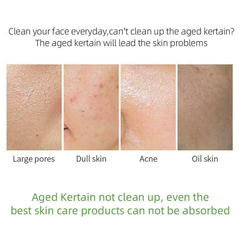 BEST Exfoliating Peeling Gel Scrub Moisturizing Whitening Sale P5O5 E6B4