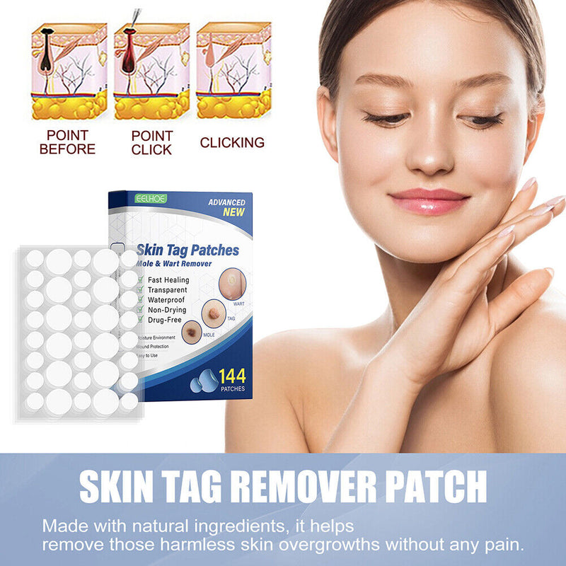 #A 144pcs Skin Tag Remover Patches Breathable Wart Treatment Stickers Cleaning