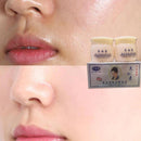 Aufhellende Anti-Freckle-Gesichtscreme Dark Spot Corrector Woman Face Care.