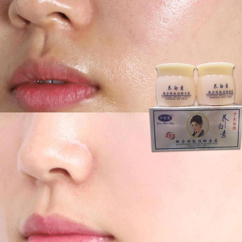 Aufhellende Anti-Freckle-Gesichtscreme Dark Spot Corrector Woman Face Care.