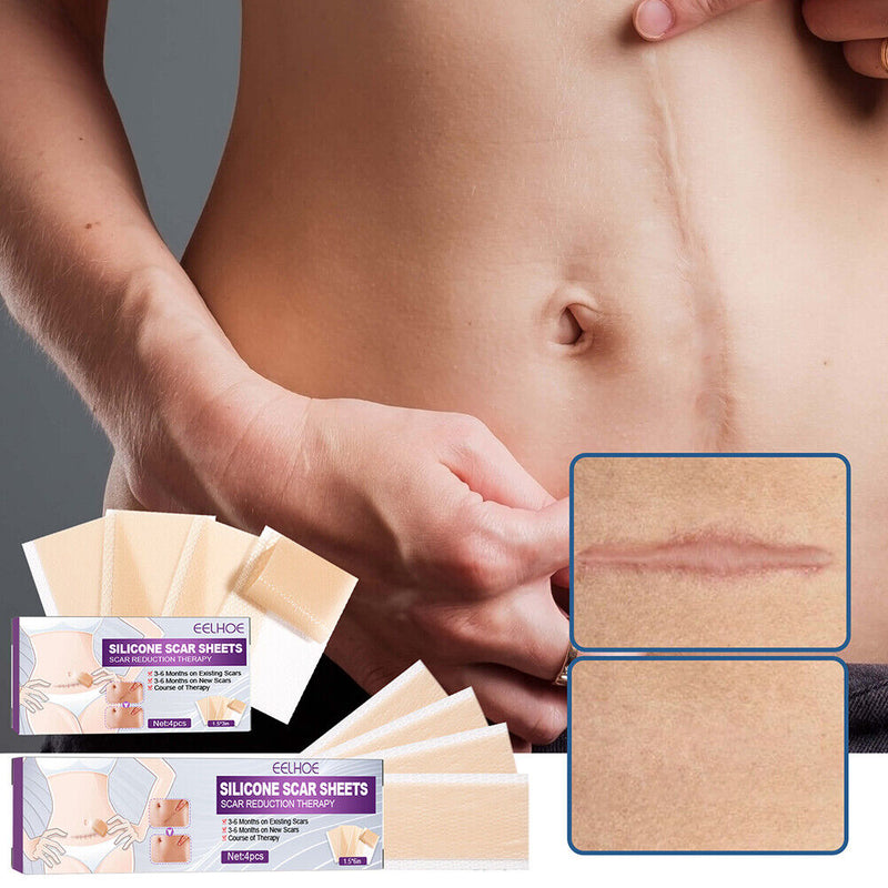 4pcs Silicone Scar Sheets Gel Strips Patch Reusable Scar Removes Remove Tra