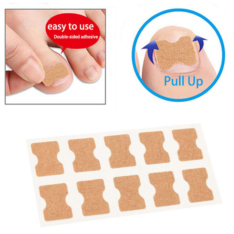 Ingrown Toenail Correction Fixer Recover Nail Patch Kit Foot Care Stickers Tool