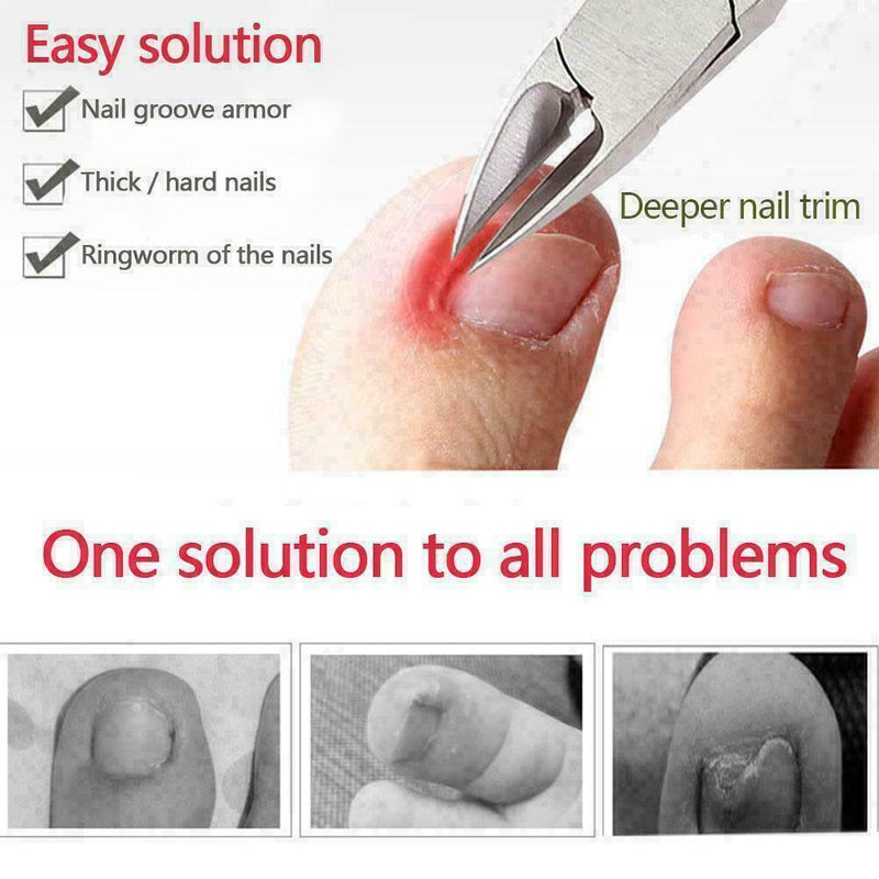Toenail Clippers For Thick Ingrown Toe Nails Heavy Duty Nail T1Y5 Scissors I2L3