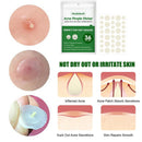 36 Patches Waterproof Acne Pimple Patch Stickers Acne FAST Pimple Remover H8K1