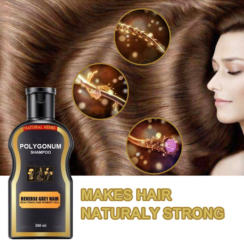 Polygonum Plants Extract Shampoo Anti-hair Loss Treatment Shampoo for Men Wom