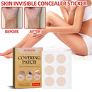 #A Skin Tone Concealer Tattoo Stickers Cover Up Scars Birthmark Patch Waterproof