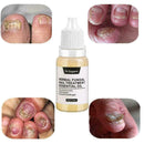 Nail Fungus Treatment Nail Oil Pen Anti Fungal Nail Remove Q4Y8 L0J1 C8K4