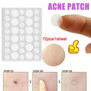 72pcs Skin Tag Remover Patches Hydrocolloid Acne Pimple Wart Remover Plaster.